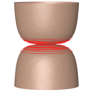 [A KK-monopole together with a collection of winding strings
		'condensed' near the monopole core.]